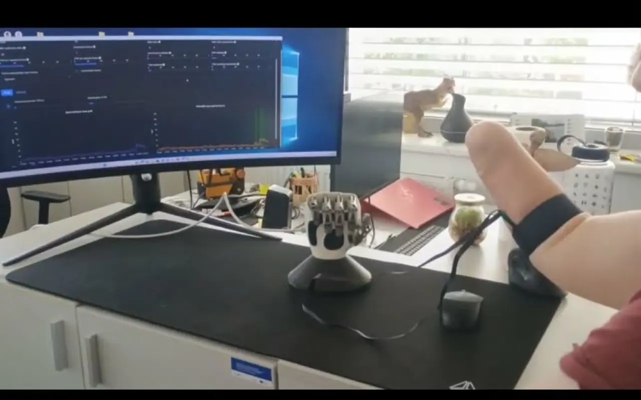 Ruka pro Naďu