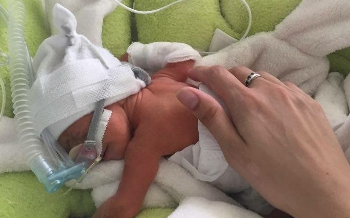 Složili jste se na čepičky pro předčasně narozená miminka