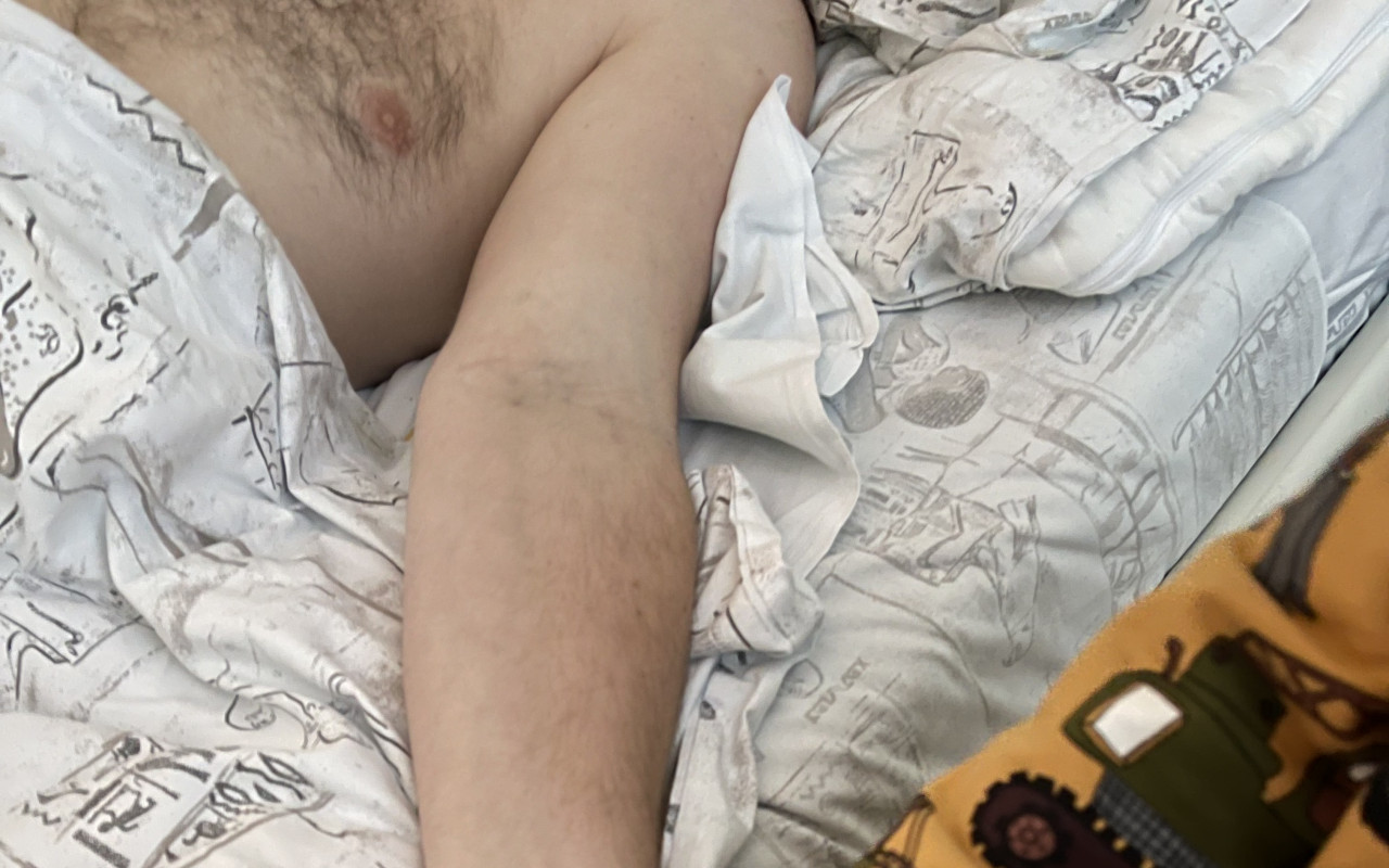 Pomoc Lukášovi, který potřebuje vozíček