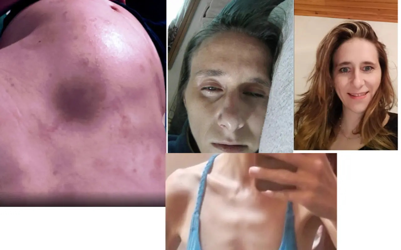 Kačka bojuje o život – šanci jí dává operace střev