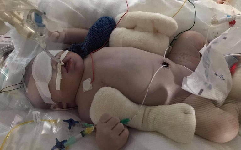 Pomohli jste Kryštůfkovi, který bojuje s řadou diagnoz