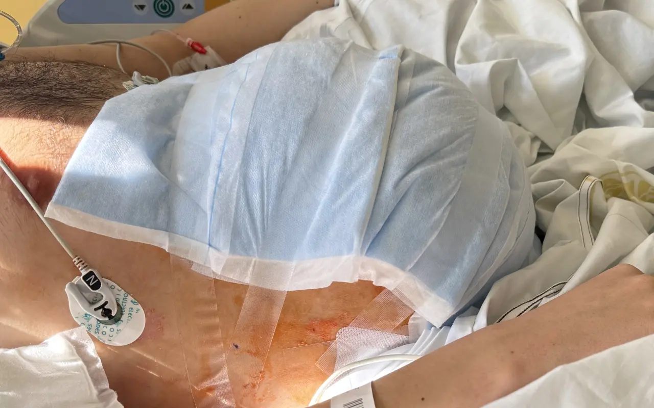 Můžete Miroslavovi zachránit život a pomoci zaplatit léčbu
