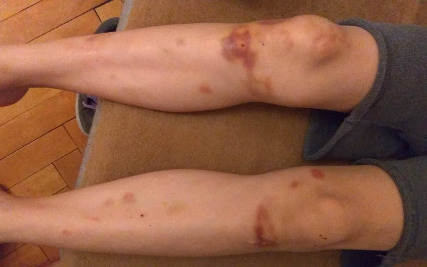 Pomohli jste  Dominikovi, který trpí dvěmi závažnými nemocemi.