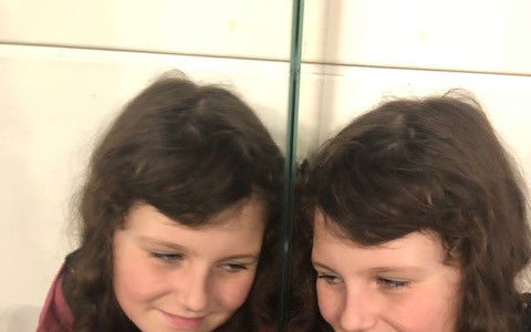 Jasmínka moc chce mluvit, kmenové buňky pomohou.