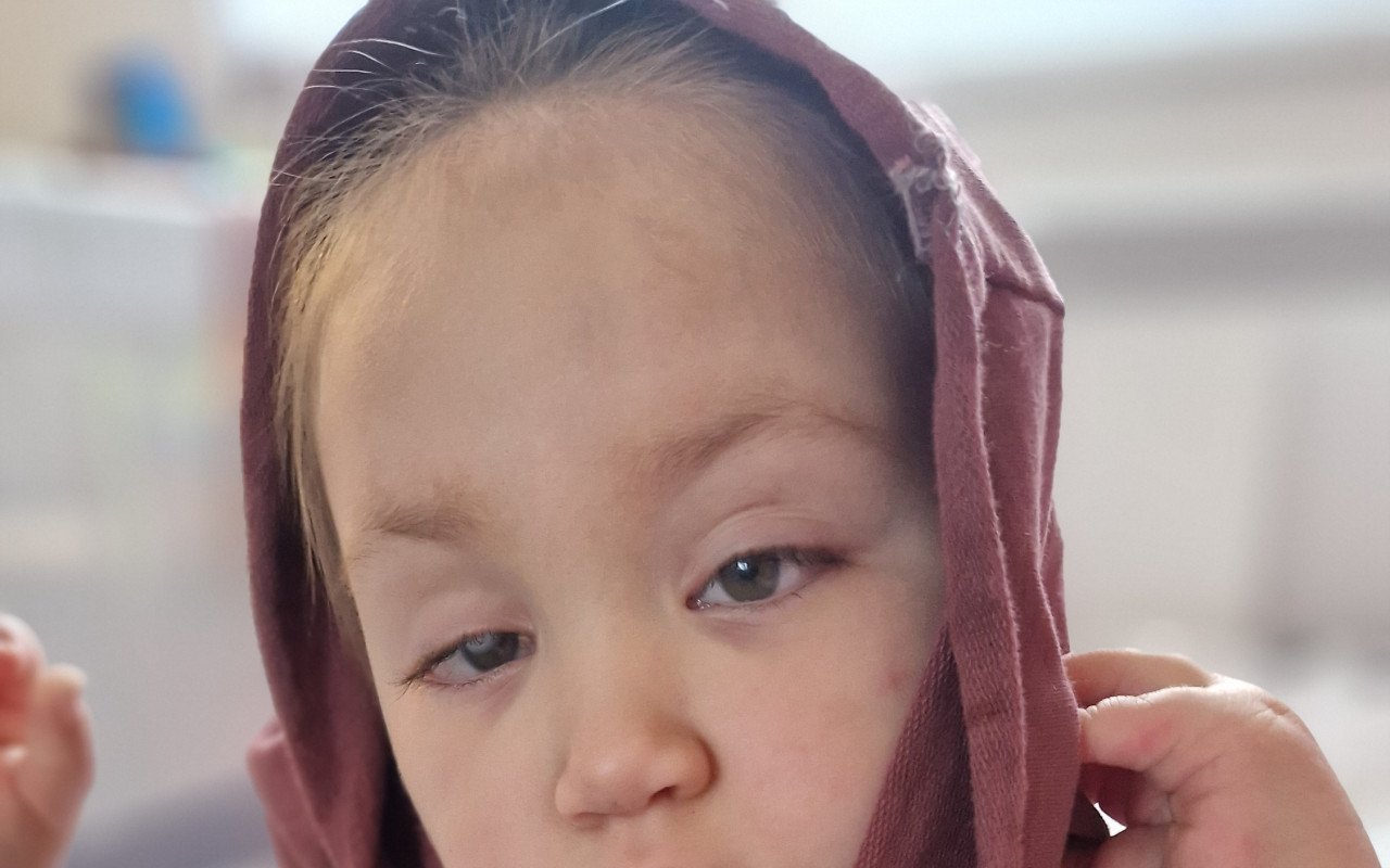 Laurinka s Kabuki syndromem potřebuje auto