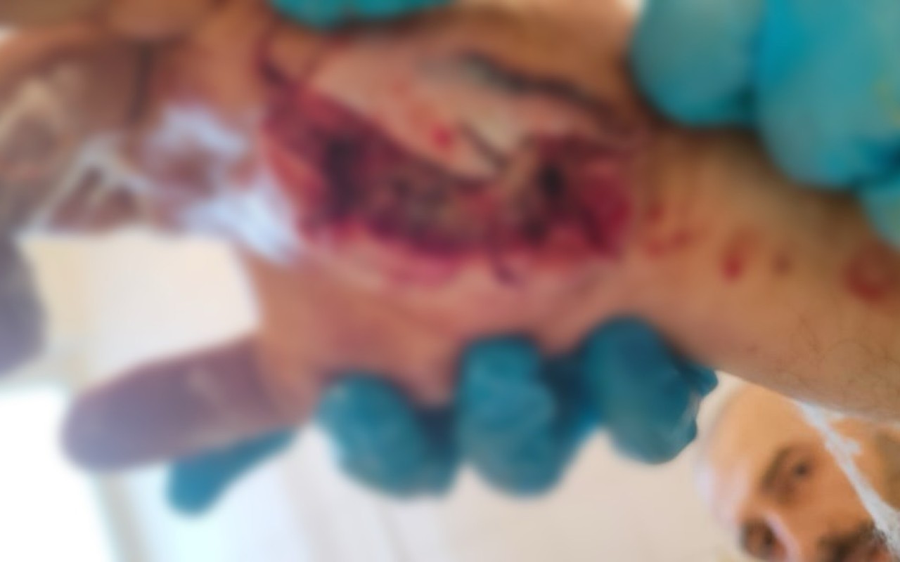 Pomohli jste přispět na rehabilitační pobyty pro ukrajinské veterány