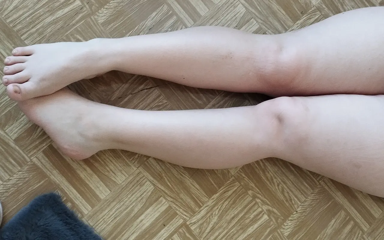 ❤️ Pomozme Sofince zvládat bolest i běžný život bezpečně