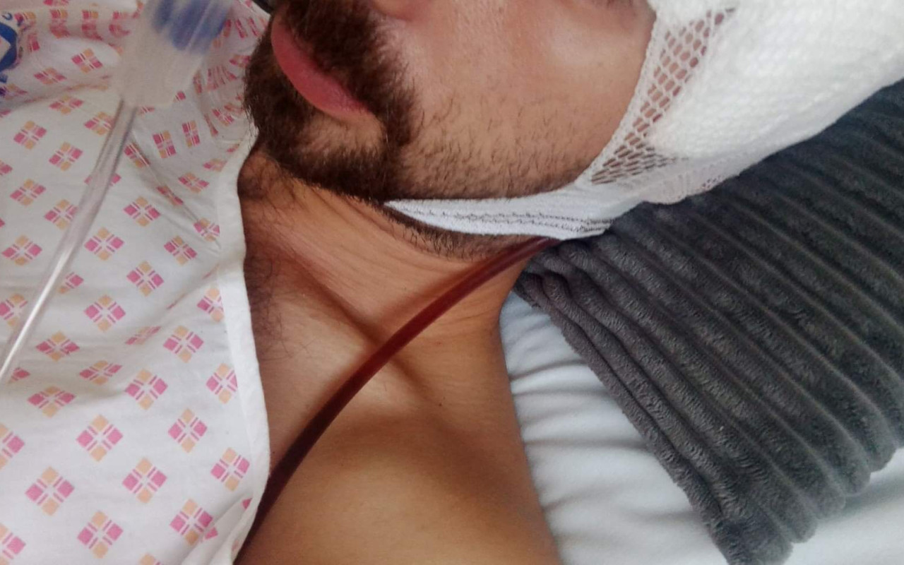 Pomoc na léčbu bratrovi