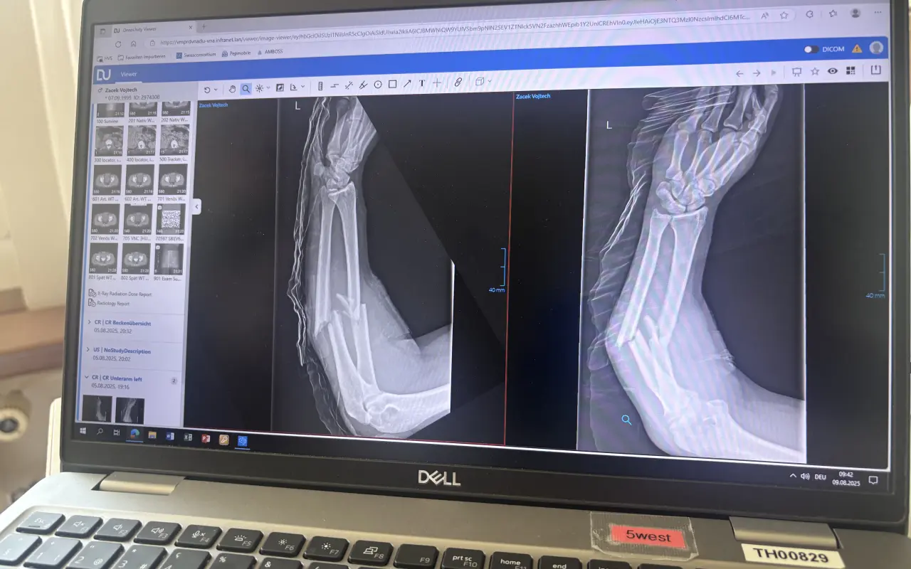 Podpořte mou cestu na Mistrovství světa v downhill skateboardingu