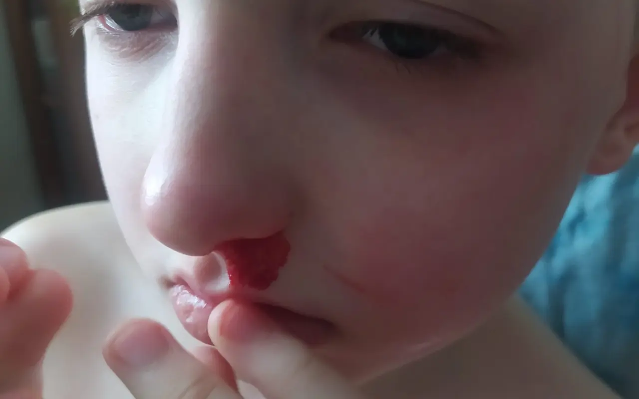 Pomozme Máťovi opustit čtyři stěny