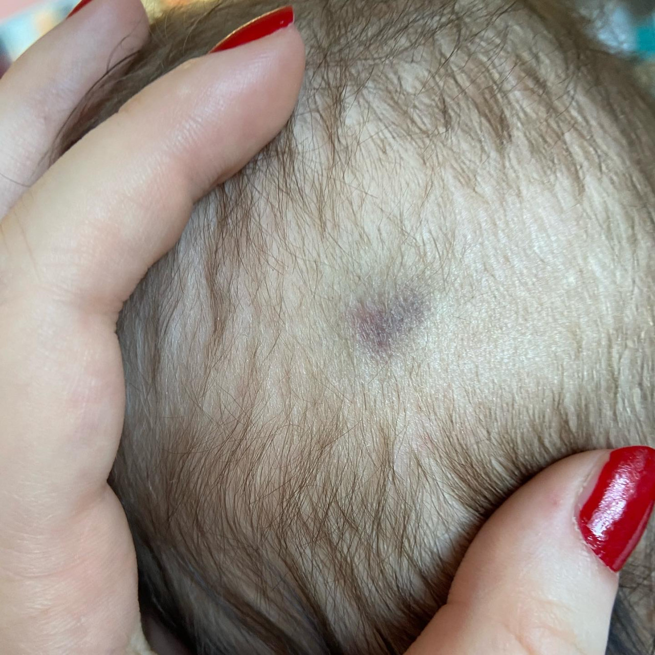 Pomohli jste Theodorkovi s těžkou formou HEMOFILIE typu A