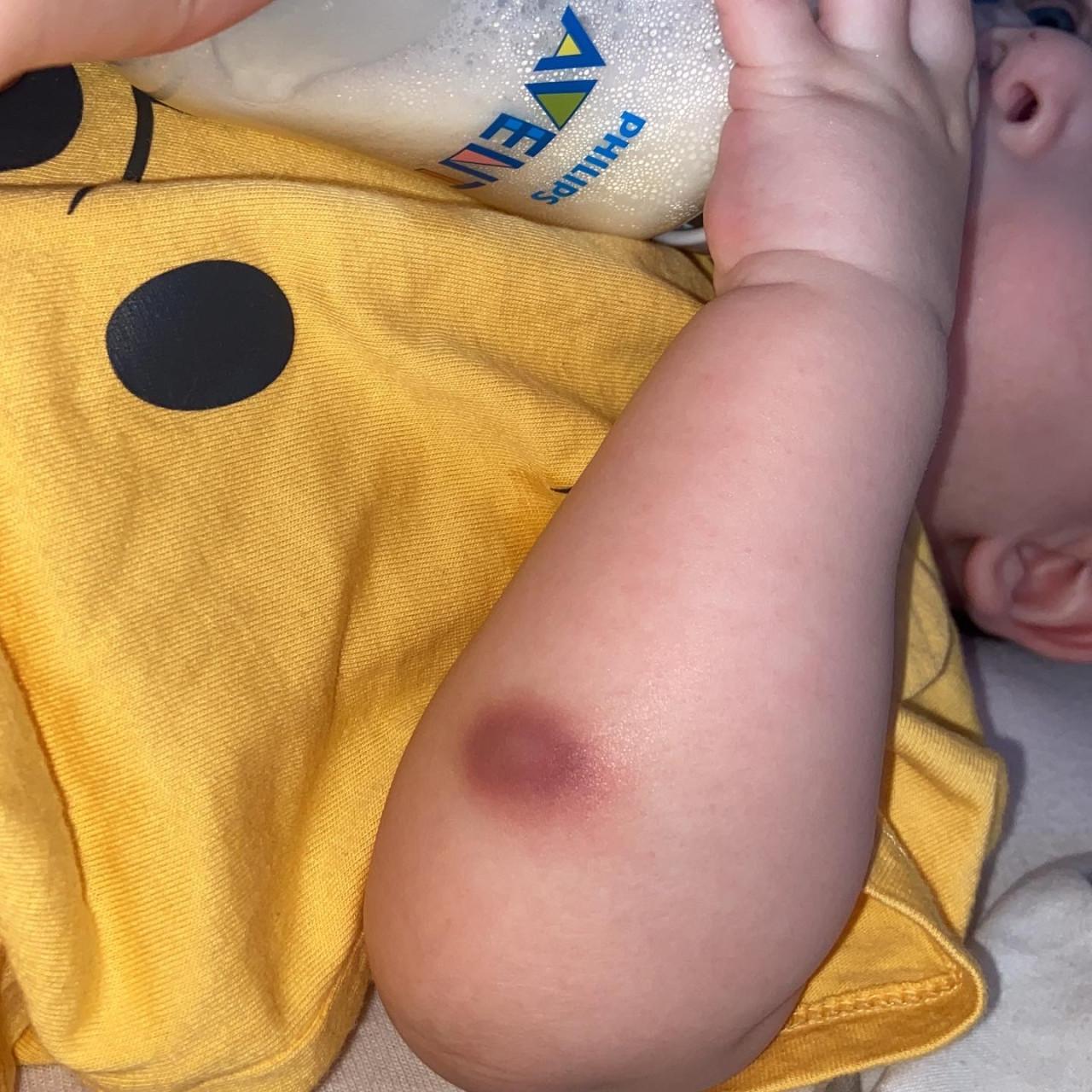 Pomohli jste Theodorkovi s těžkou formou HEMOFILIE typu A