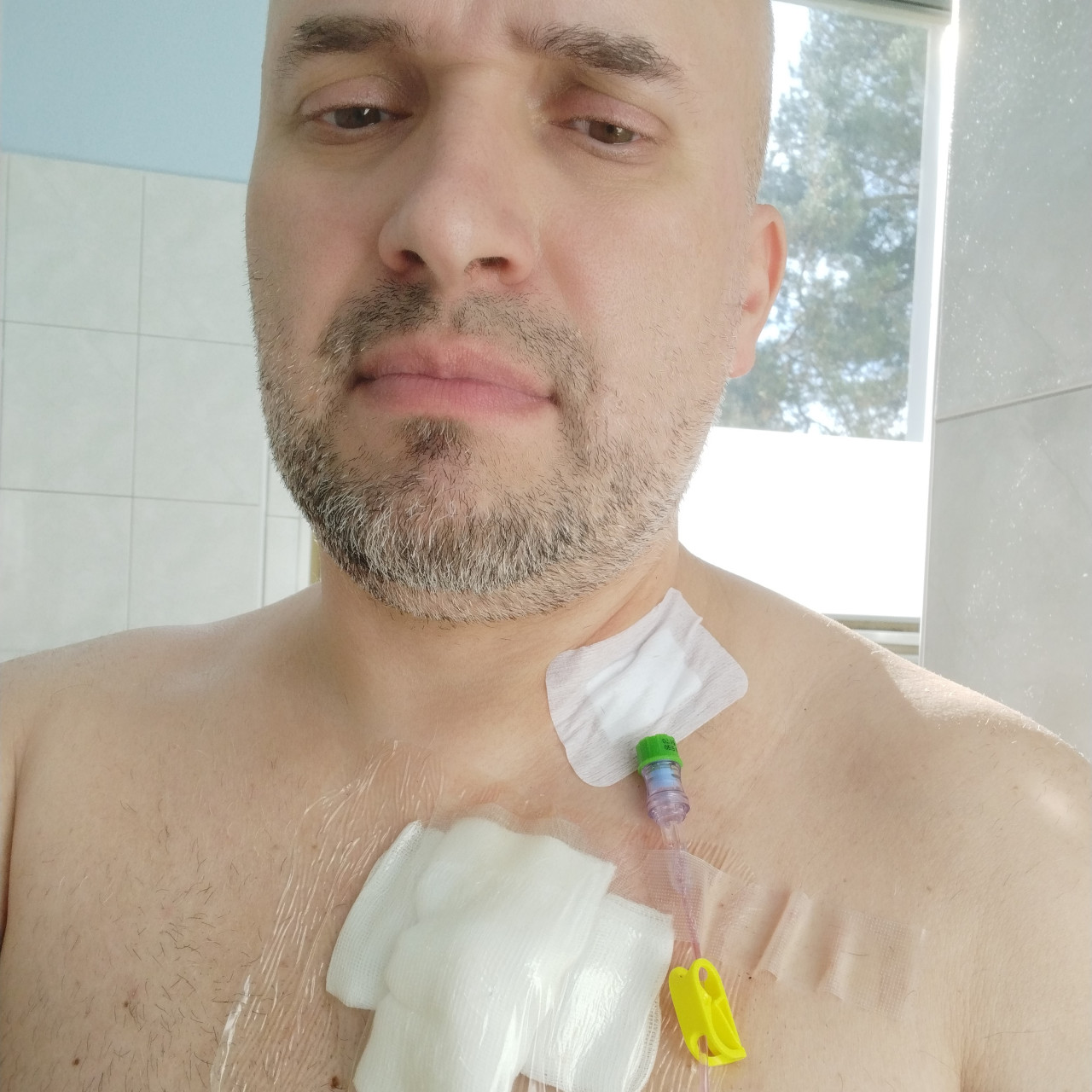 Uhradili jste onkologický přípravek pro Standu