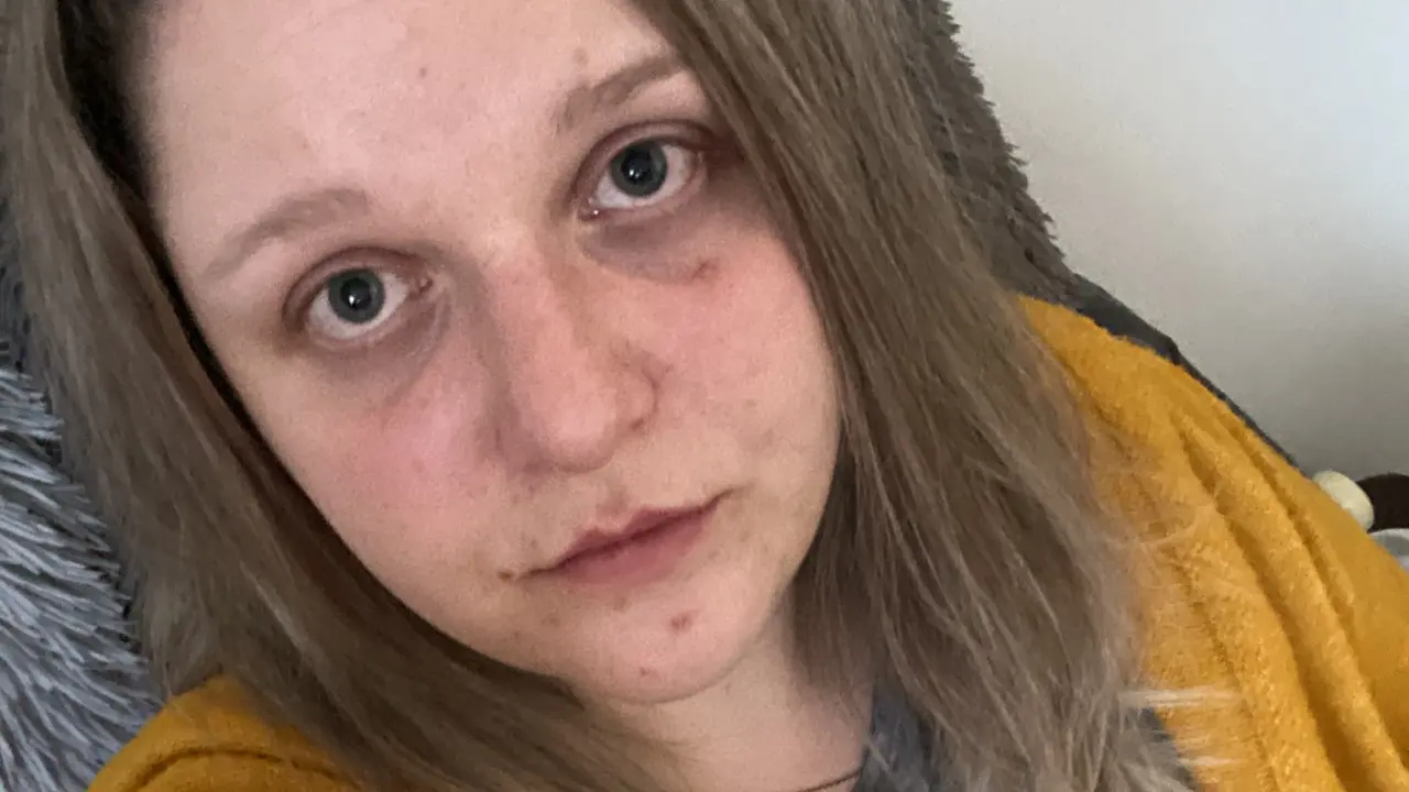 Pomozte Kristince v psychické tísni