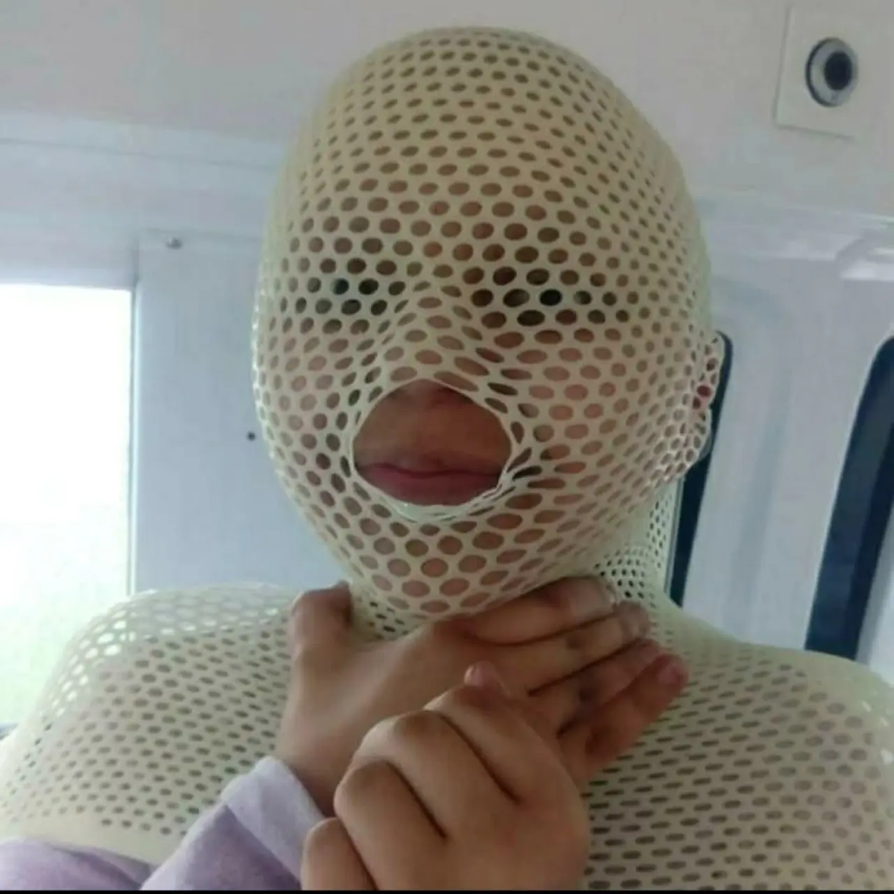 Nele na nové zuby