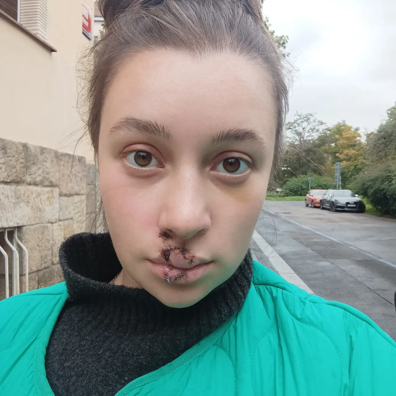 Pomohli jste mi vrátit úsměv po těžkém úrazu