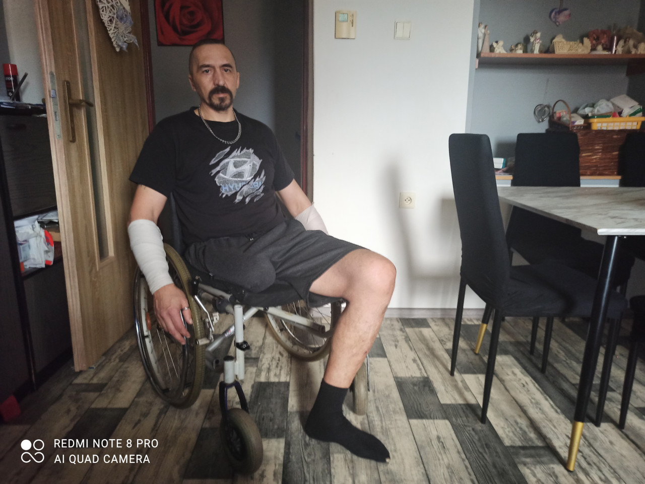 Léčebné výdaje, kompenzační pomůcky