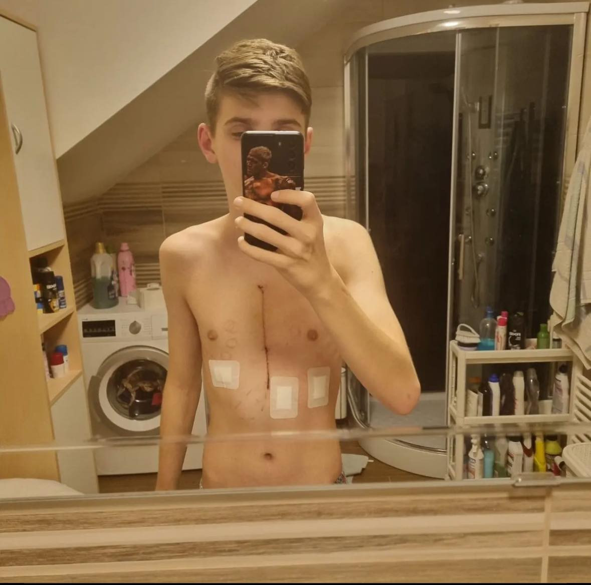 Domov pro nemocného Dominika a jeho rodinu