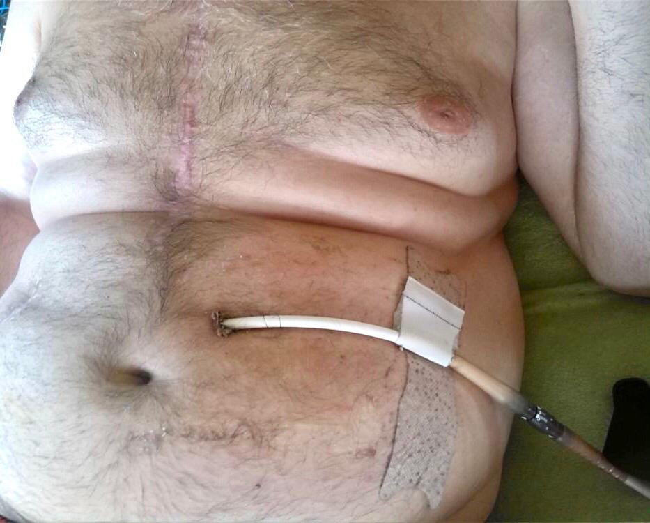 Pomohli jste zařídit bezpečný domov po transplantaci srdce
