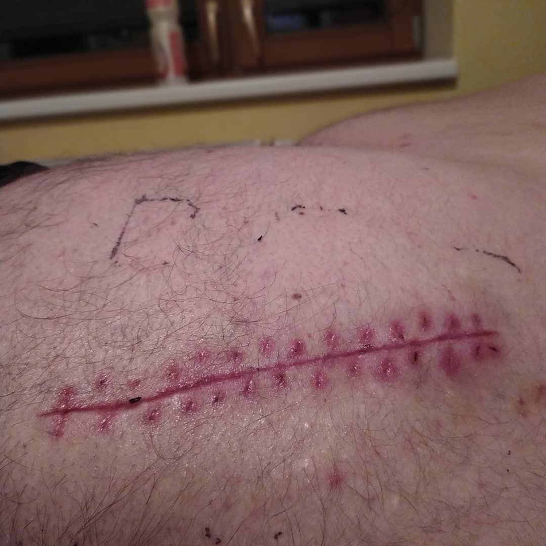 Pomoc pro Pavla, aby byl opět prospěšný společnosti