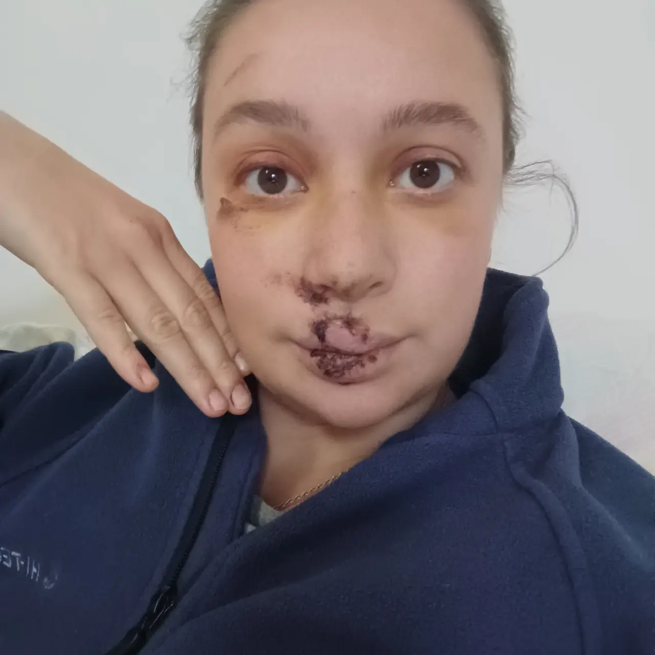 Pomohli jste mi vrátit úsměv po těžkém úrazu