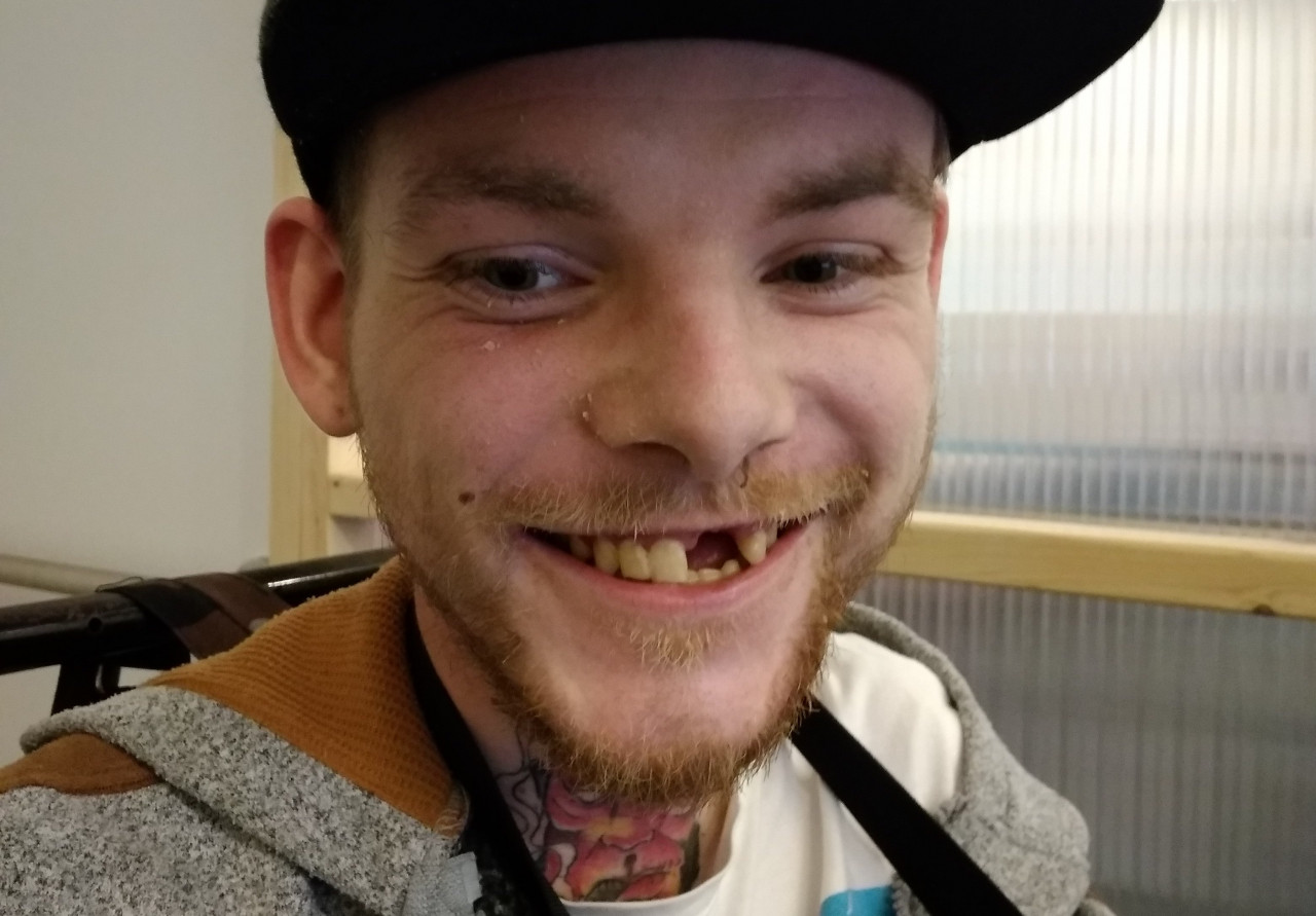 Pomozme Arturovi vrátit zpátky jeho úsměv
