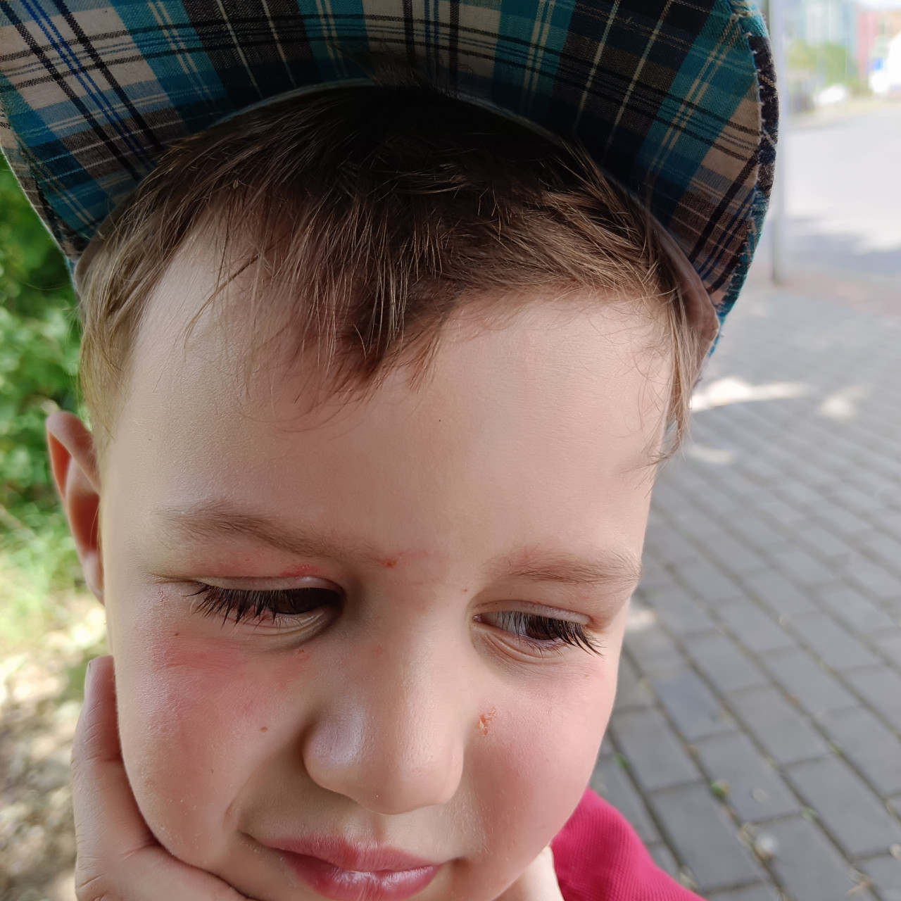 Pomoc těžce postiženému chlapečkovi zlepšit život