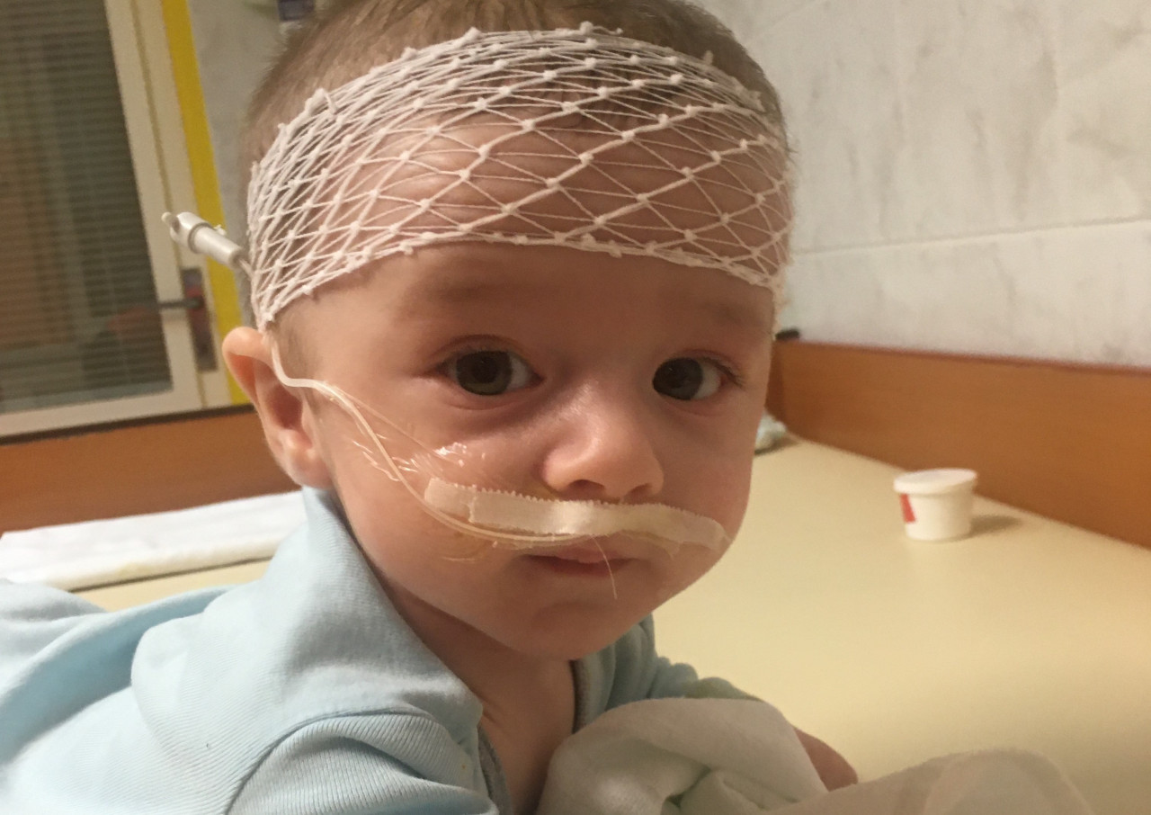 Mareček potřebuje podstoupit speciální terapii, aby se naučil jíst