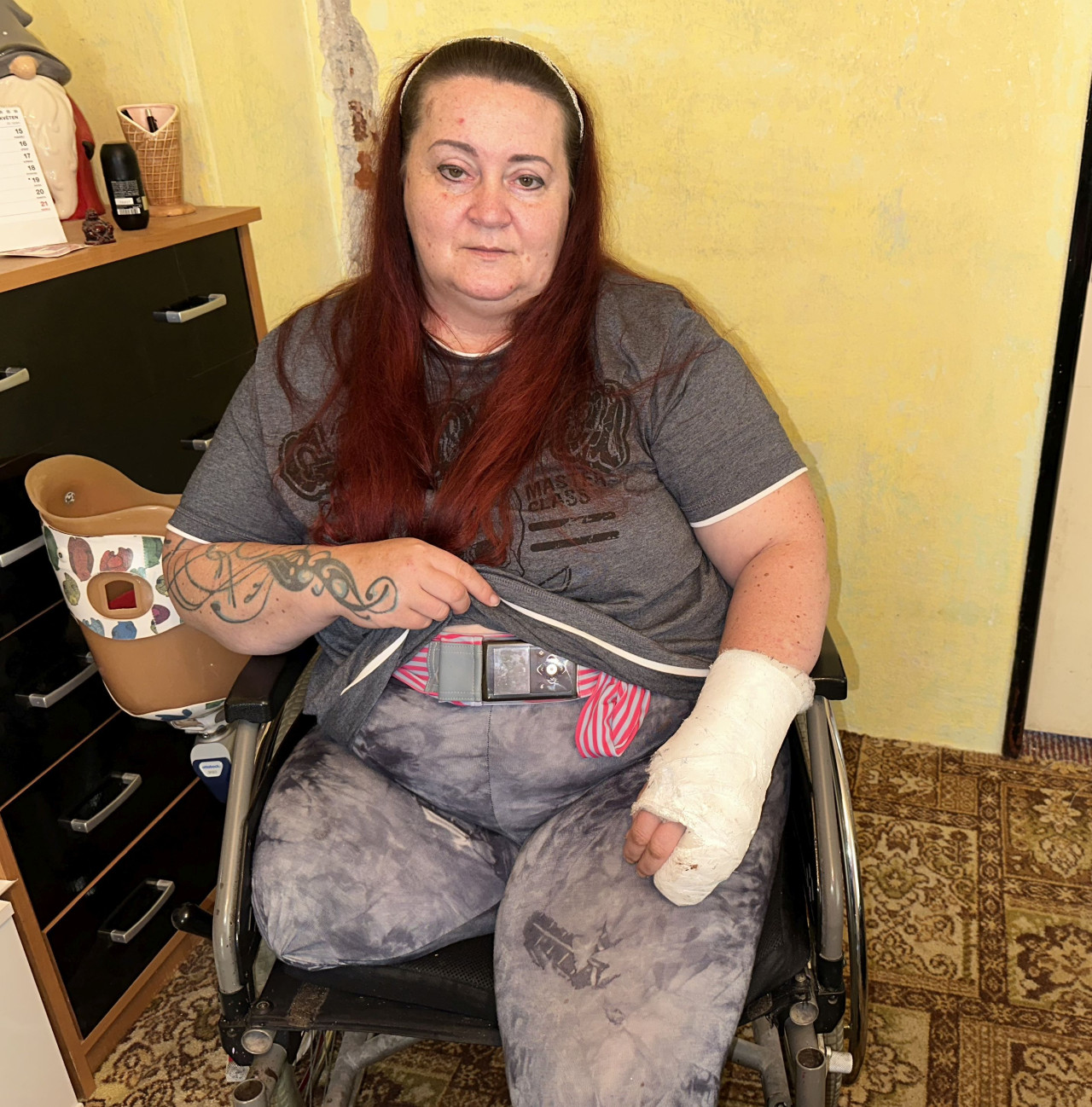 Paní Vilémě, která přišla o končetinu, rodinnou domácnost i životní elán