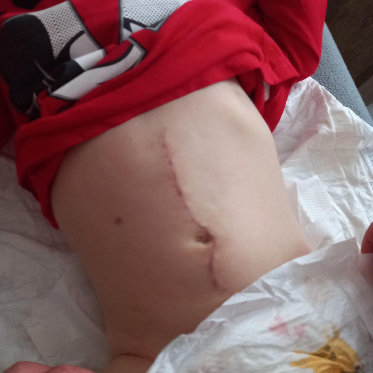 Pomohli jste přispět na sbírku pro Petříka po transplantaci kostní dřeně