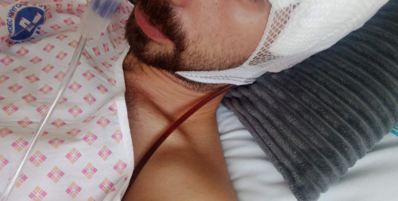 Pomoc na léčbu bratrovi