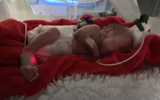 Epialarm a terapie pro malého Jarouška