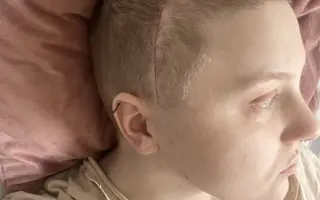 Dvacetiletá Lucka s nádorem mozku chce dál žít a smát se
