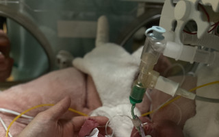 Nový unikátní plicní ventilátor pro nedonošená miminka