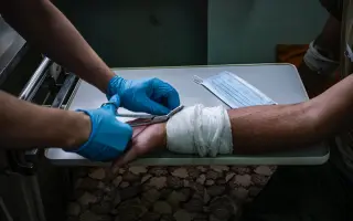 Ať nemusí amputovat...