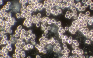 Rodina dobrovolných hasičů bojuje – pomozme Monice pokračovat v léčbě