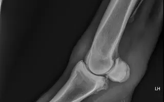 Valášek Artuš z Bezdědic - léčba a rehabilitace zlomeniny