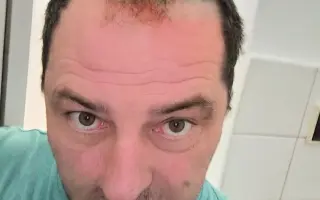 Pomoc pro manžela s multifokálním glioblastomem