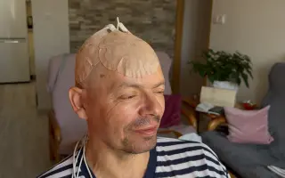 Šance na život pro horského průvodce Vaška