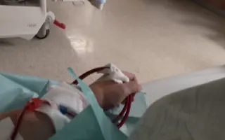 Pomoc s transplantací ledviny – šance na delší život