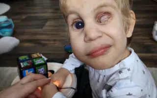 Tobiáškovi pro lepší život s Loweho syndromem