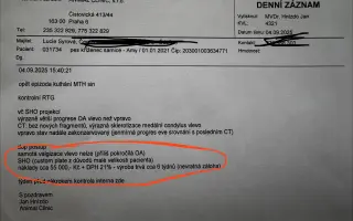 Amy potřebuje další operaci pro bezbolestné procházky