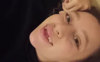 Pomozte mi vrátit úsměv po těžkém úrazu