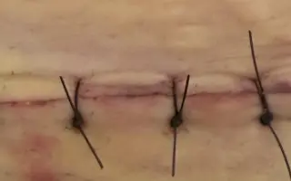 Pomoc pro mámu, které se rozpadají kosti a nechce se vzdát