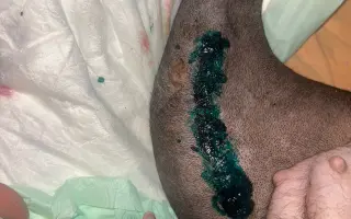 (⁠✿⁠ ⁠♡⁠‿⁠♡⁠)  Pro Koru, aby mohla opět běhat