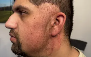 Pomoc Lukášovi a jeho rodině v období léčby