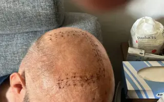 Pomozme tátovi tří dětí v nejtěžším boji s nádorem mozku