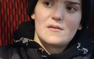 Rekonstrukce chrupu pro Haničku