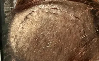 Naděje pro renesanční dámu: Optune TTF