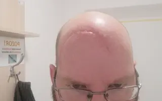 Pomozme Honzovi podpořit léčbu nádoru mozku
